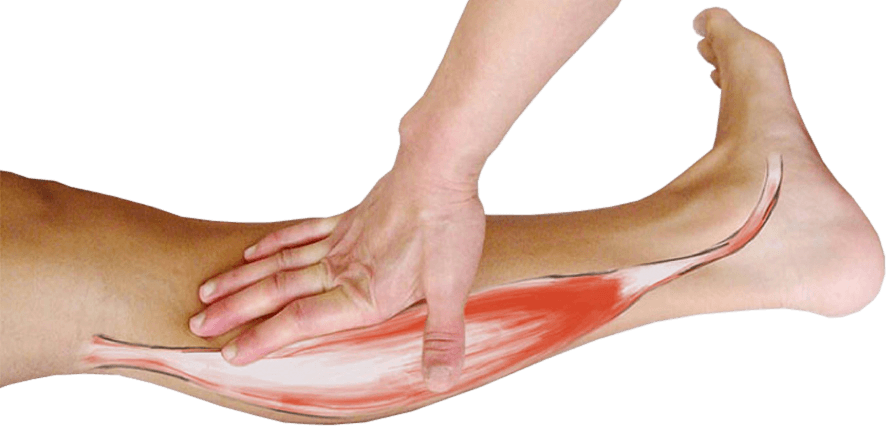De achterste scheenbeenspier (tibialis posterior) De achterste scheenbeenspier (tibialis posterior)